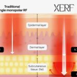 XERF product photo