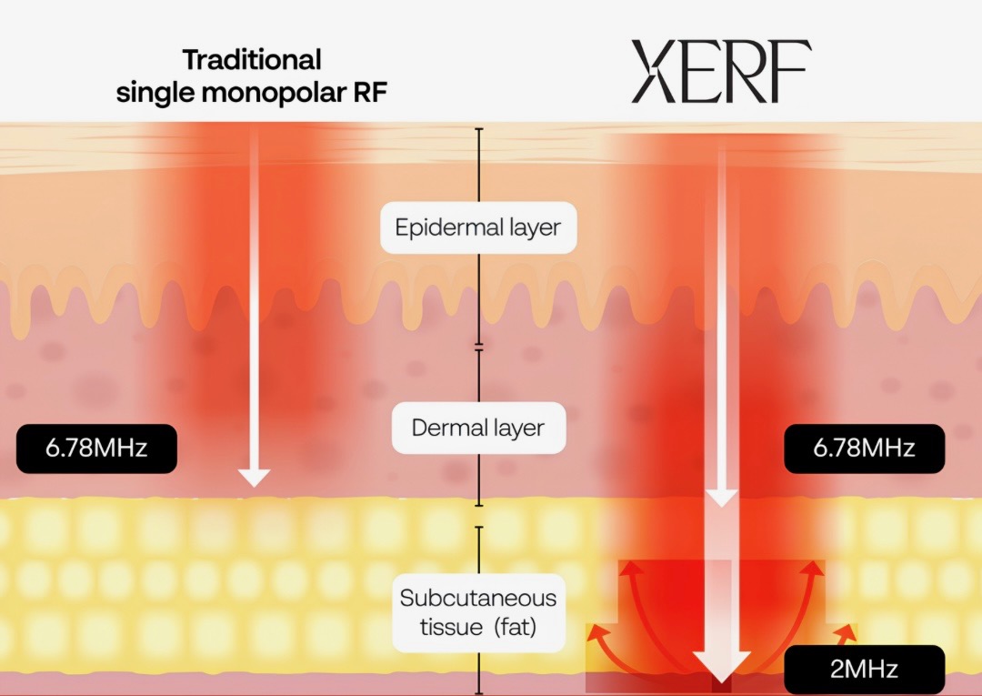 XERF product photo